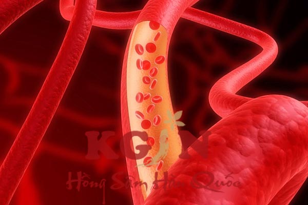 nấm linh chi có tác dụng giảm cholesterol trong máu